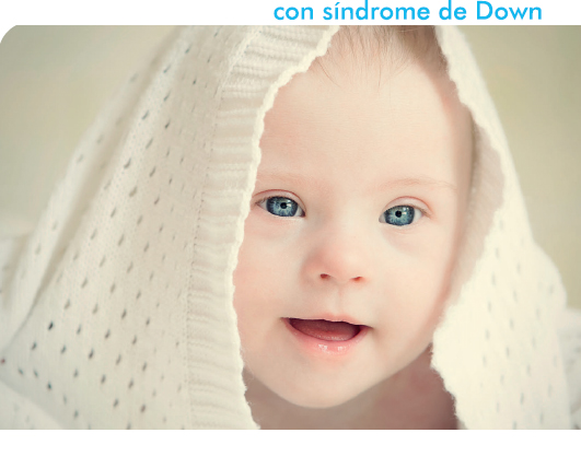 El ‘Programa de salud baby’, la guía para cuidar la salud de los bebés con síndrome de Down