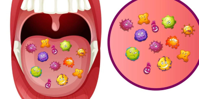 Descubren una bacteria presente en las personas con síndrome de Down que previene las caries  