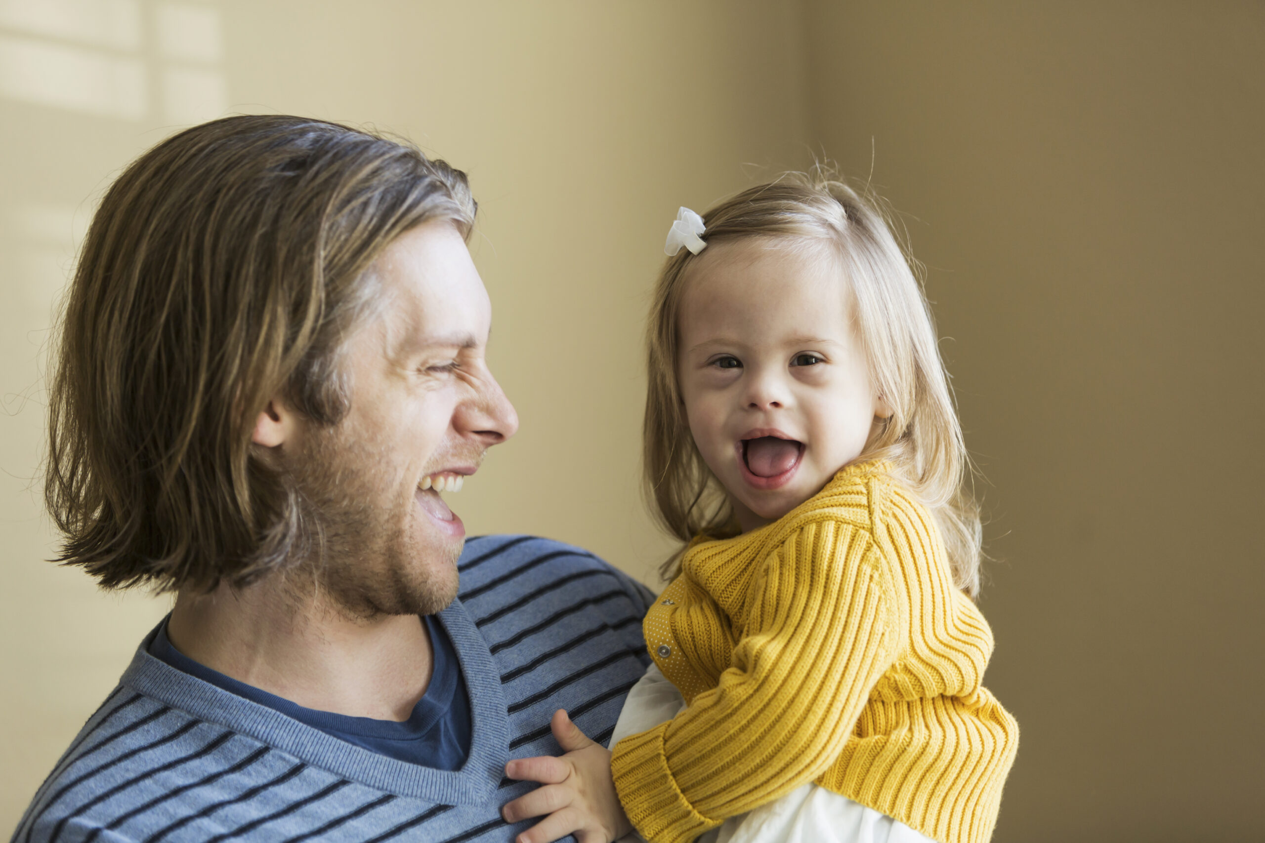 Father (30s) holding daughter (2 years) with down syndrome.